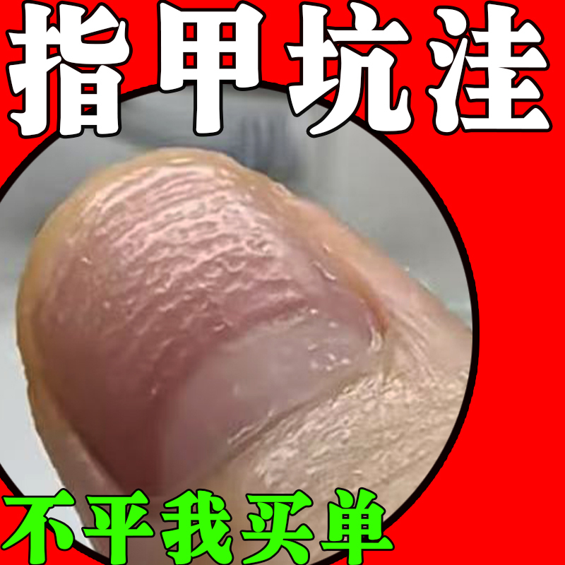 Nail Pits and Bumps, Uneven Nails, Damaged Nails, Sunken, Shrunk, Cracked Nails, Nutrient-Deficient Nail Repair Solution Nail Pits and Bumps, Uneven Nails, Damaged Nails, Sunken, Shrunk, Cracked Nails, Nutrient-Deficient Nail Repair Solution