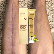 Scar Remove Cream Stch Marks Acne Spots Surgical Burn Scar