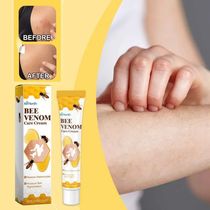 Bee Venom Vitiligo Treatment Cream Natural Relief Skin Treat