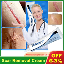 Remove Burn Scars Cream Gel Remove Stch Marks Acne Spots Tre