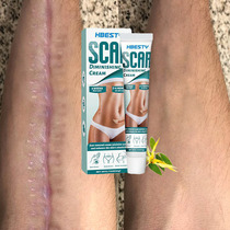 Scar Removal Cream Maternity Pregnancy Burn Surgical Scar Sp