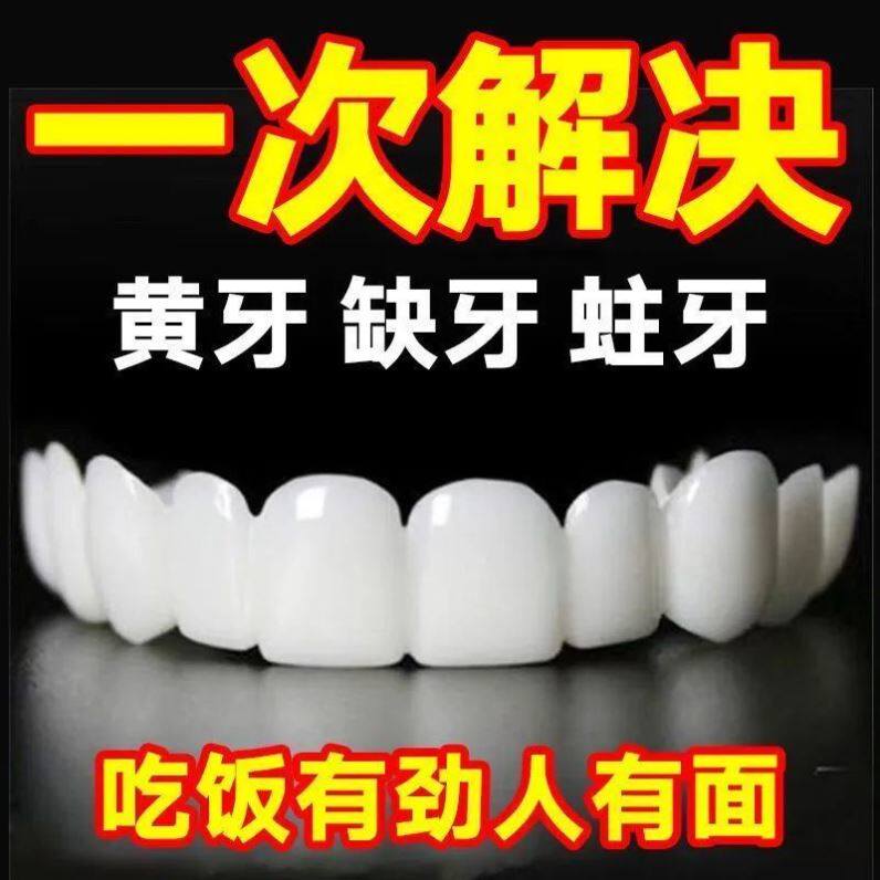 门牙贴片临时牙套：瞬间变美，告别牙齿烦恼！🌟-电子美牙产品-淘宝百科网
