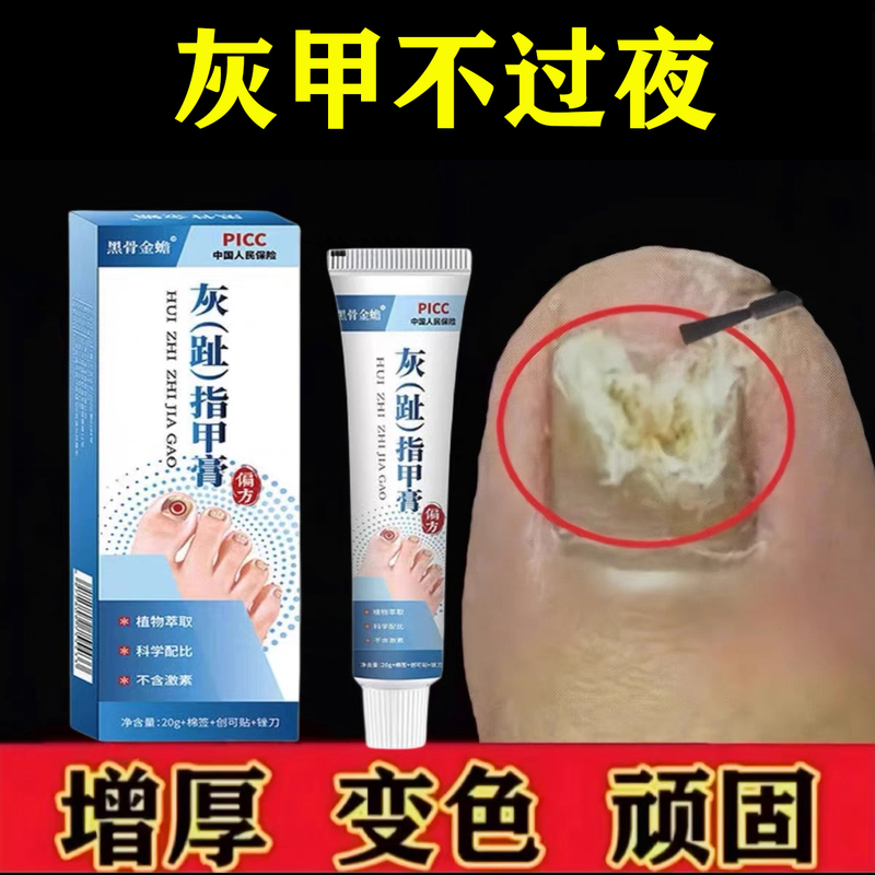 【Universal for Hands and Toes】Herbal Plant Solution for Nails, Specifically for Severe Nail Groove Issues, Nail Thickening, and Nail Brightening