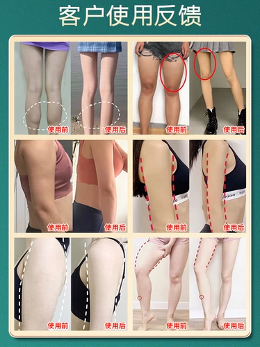 [9 дней худой тонкой тонкой ноги не отступают] купить 5 и получить 5 свободных ног и периодов лактации груди на бедре могут быть использованы для мужчин и женщин