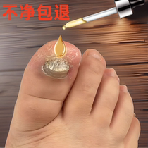Tong Ren Tang hot sale (no guarantee or repair). Just a drop of potassium can turn bad nails into good ones grow new nails inhibit bacteria and not remove nails.