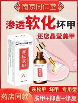 Drop a drop to inhibit bacteria and remove nail fungus remove 99% of gray potassium fungus and turn bad nail into good nail.