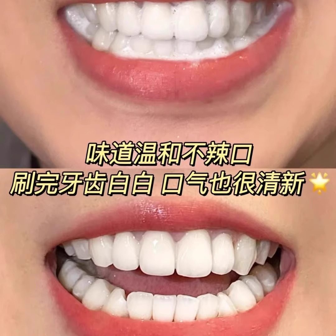 Ocean Supreme Ice Whitening Toothpaste with Probiotics Freshens Breath, Removes Smoke Stains, Whitens Yellow Teeth, Anti-Cavity Genuine Product