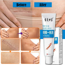 Scar Removal Cream For Woman Man Old Scars Stch Mark for Stc