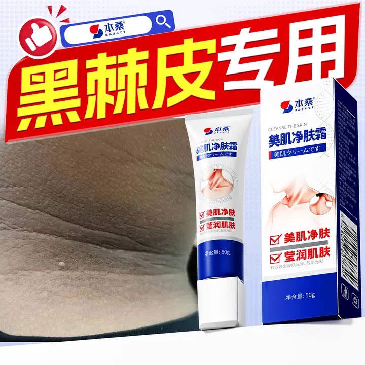 去脖子黑棘皮病药膏神器去黑后颈部去黑色素沉淀去除颈部美白霜