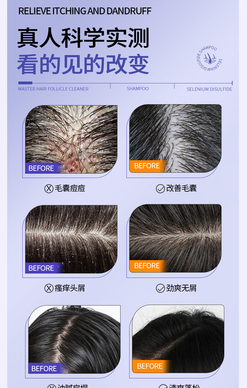安享好物 安享B级洗发水-植蔻兰二硫化硒洗发水  