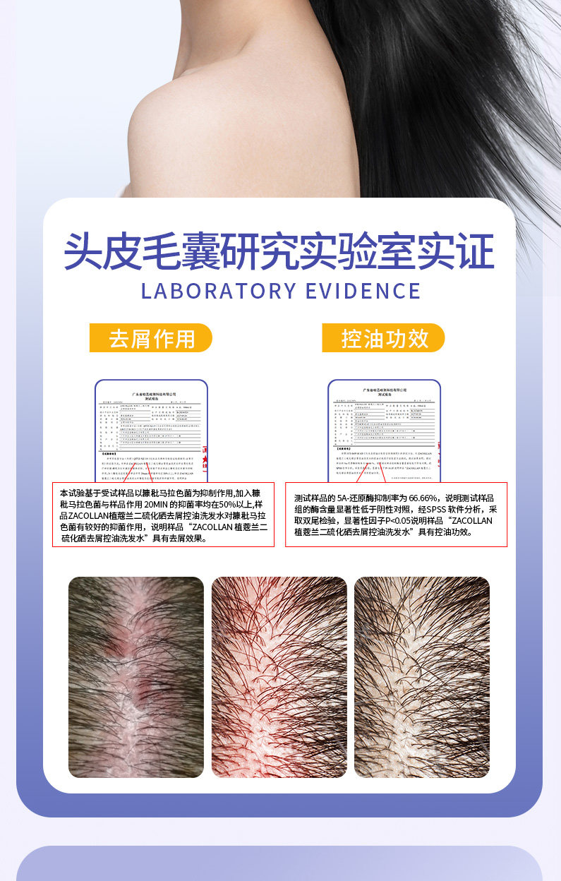 安享好物 安享B级洗发水-植蔻兰二硫化硒洗发水  