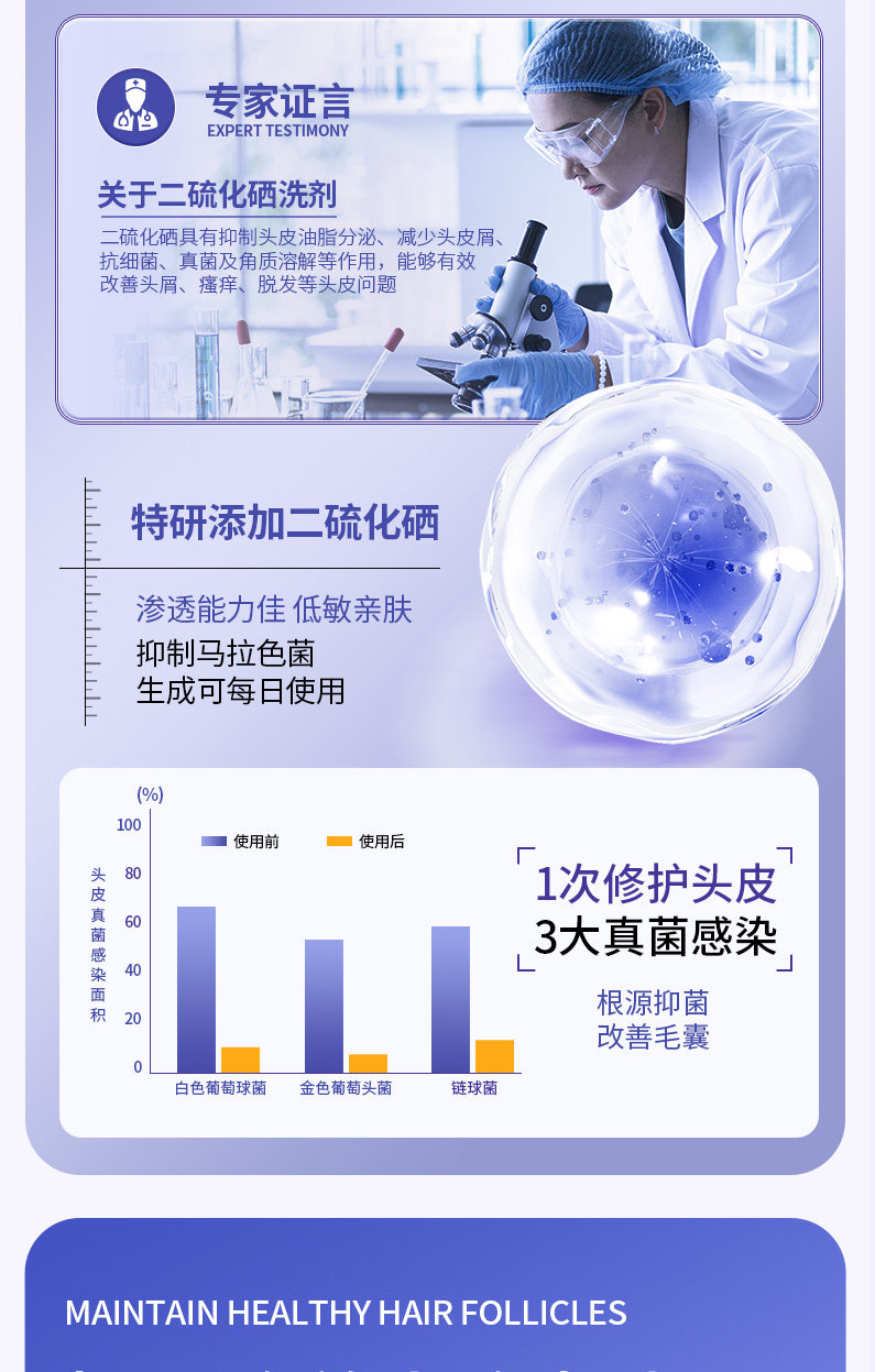 安享好物 安享B级洗发水-植蔻兰二硫化硒洗发水  