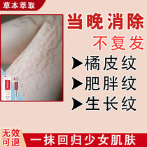 Obesity mark repair cream stretch marks obesity growth mark repair moisturizing pregnancy mark suppression cream unisex ointment