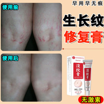 Obesity mark removal repair and lightening of stretch marks obesity and growth marks moisturizing lightening and tightening of lines prevention of