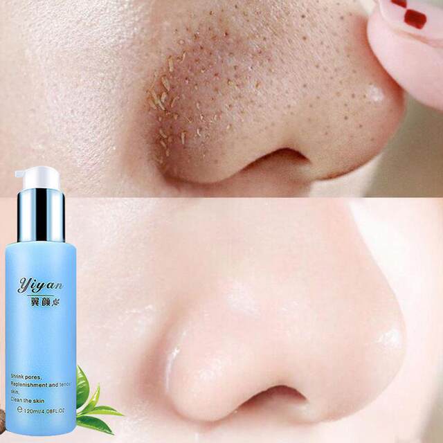 Buy One Get One Free Wing Face Shrinking Pore Essence Water Gentle Hydrating Brightening Skin Oil Control Firming Moisturizing Lotion Genuine