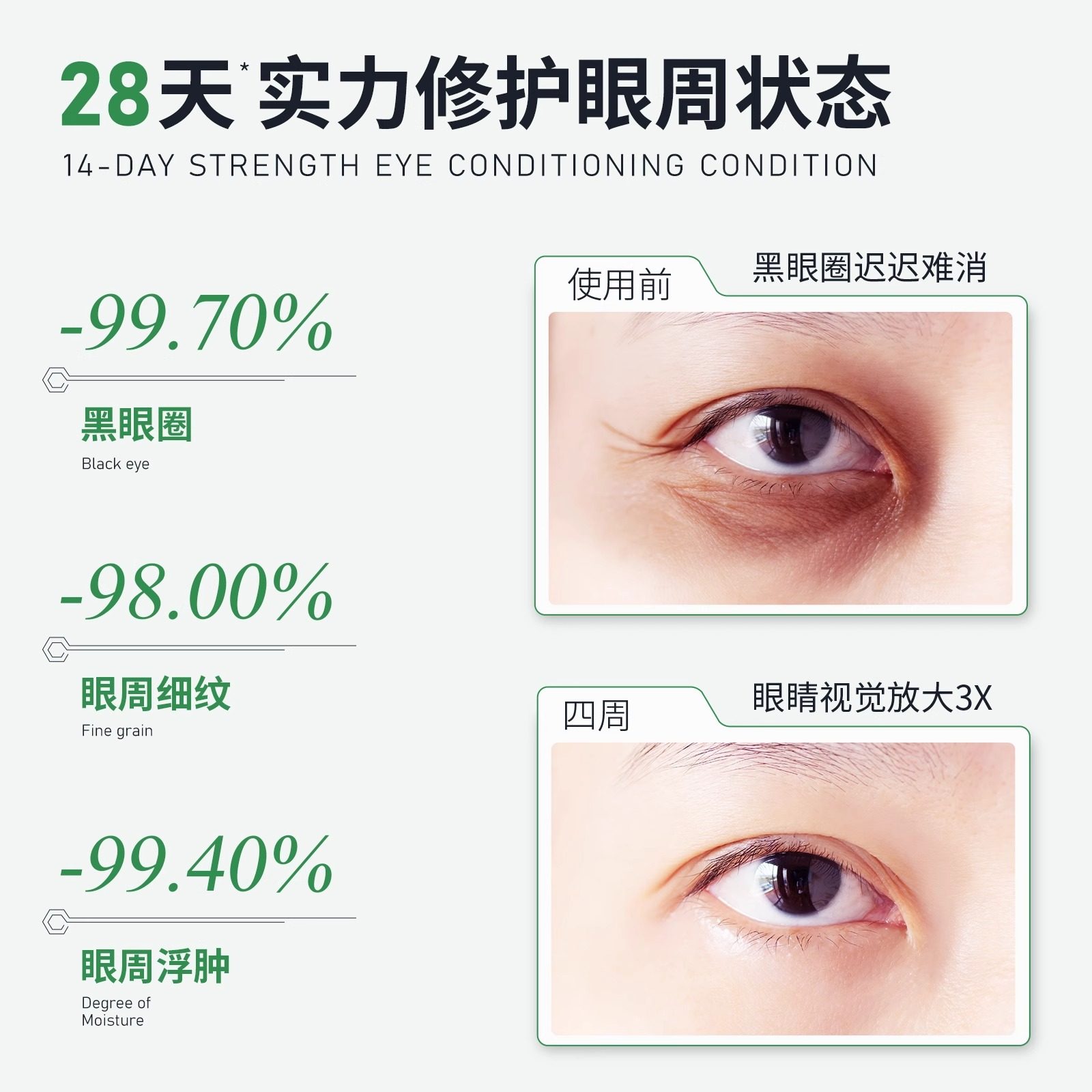 Youxi Little Green Strip Eye Cream Uocc Polypeptide Anti-Wrinkle Revitalizing Eye Cream Caffeine Anti-Wrinkle Firming Anti-Aging