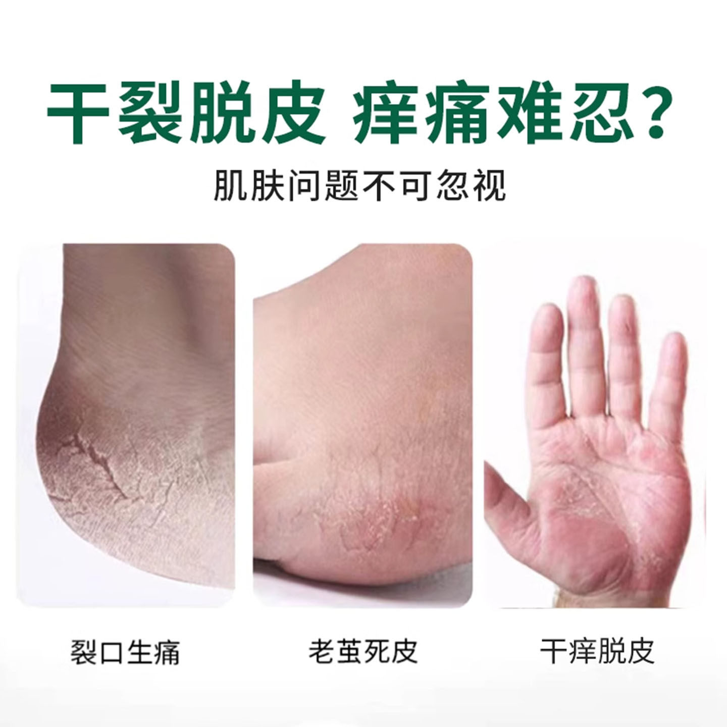秋冬手部急救!手脱皮严重?试试这款神奇药膏,告别干燥粗糙!-护手霜-淘宝好物网