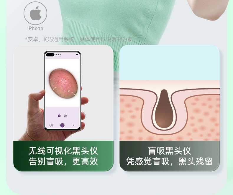 Сосать черный глава инструмент 康佳可视吸黑头仪去黑头铲粉刺电动强力吸出器清洁神器导出美容仪 Konka