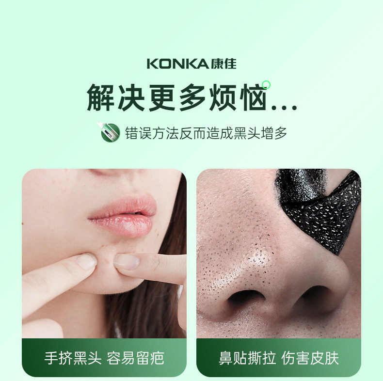 Сосать черный глава инструмент 康佳可视吸黑头仪去黑头铲粉刺电动强力吸出器清洁神器导出美容仪 Konka