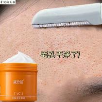 p (recommended by Xiaohongshu) Don’t squeeze let me expel the dirt and remove the garbage from facial pores. Buy 2 and get 1 free.