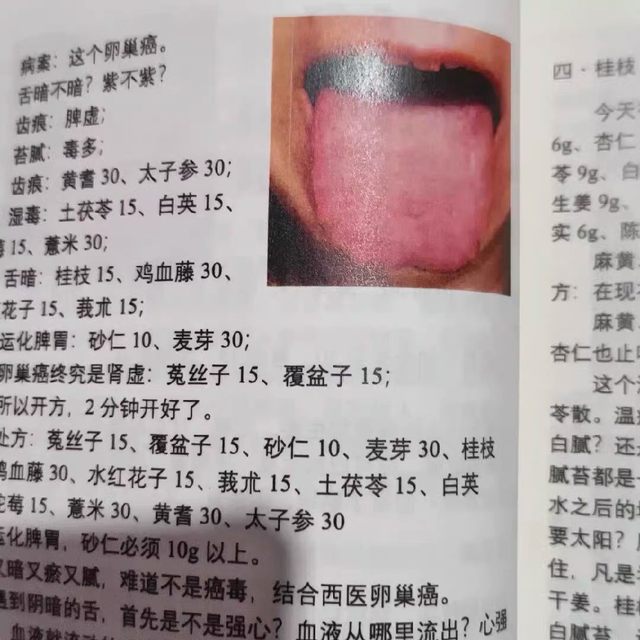 Yang Chunhu's Lecture Notes on Traditional Chinese Medicine Tongue Diagnosis, Color Printed Materials, 16-Page Format