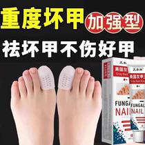 Special medicine for onychomycosis to remove onychomycosis severe nail thickening inhibit bacteria and brighten nails