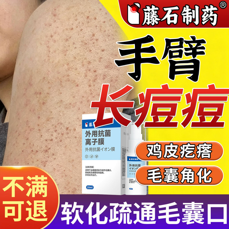 Special Spray for Arm Folliculitis, Small Bumps and Red Spots on the Arm, Keratosis of Skin, Sold in Pharmacies Om