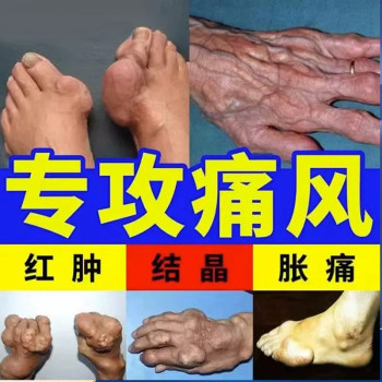 Luxiang Zhuifeng ຄີມ, spondylosis ປາກມົດລູກ, ບ່າແຊ່ແຂງ, ປະດົງຂໍ່, ປວດຂໍ້ກະດູກ, ແອວແລະຂາ, lumbar vertebra paste, ພິເສດສໍາລັບການ herniation lumbar disc