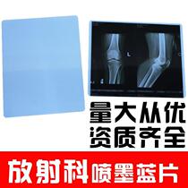 X-ray blue-based inkjet medical film DR printing CR dental 8*10 orthopedic radiology dry film A4 roll