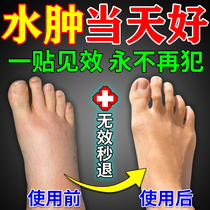 Anti-footed edema special effects of detumescence medicine elderly calf lower limb bloated edema dehumidifiers special drug themetics