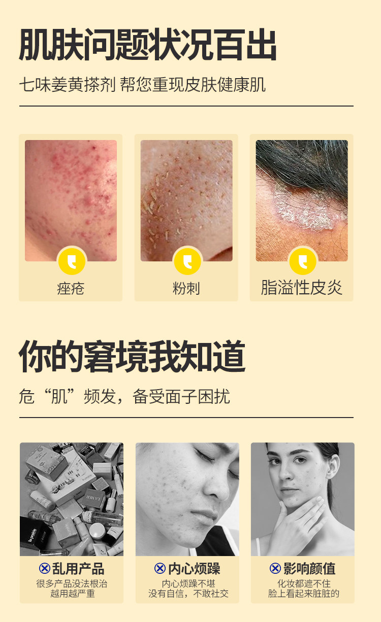 【中国直邮】 会美 七味姜黄搽剂  苗方中药 快速祛痘 闭口粉刺 痤疮脂溢性皮炎  10ml/盒