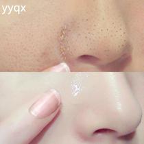 Recommended by zXiaohongshu blogger~Don’t squeeze lactobionic acid shrinks pores and cleanses facial garbage. Buy 2 and get 1 free.