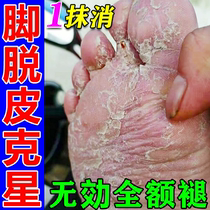 Dry cracked and peeling soles of the feet. Dry cracked and peeling skin on the palms and soles. Special cream for peeling feet. What medicine should be used for peeling feet?