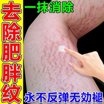 Obesity pattern repair cream growth pattern elimination thigh students dilution of stretch marks postpartum removal cream for male teenagers