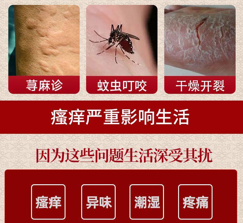 治疗顽固牛皮癣特效药膏银屑病皮肤癬藓瘙痒湿疹止痒去根股廯专用-阿里巴巴