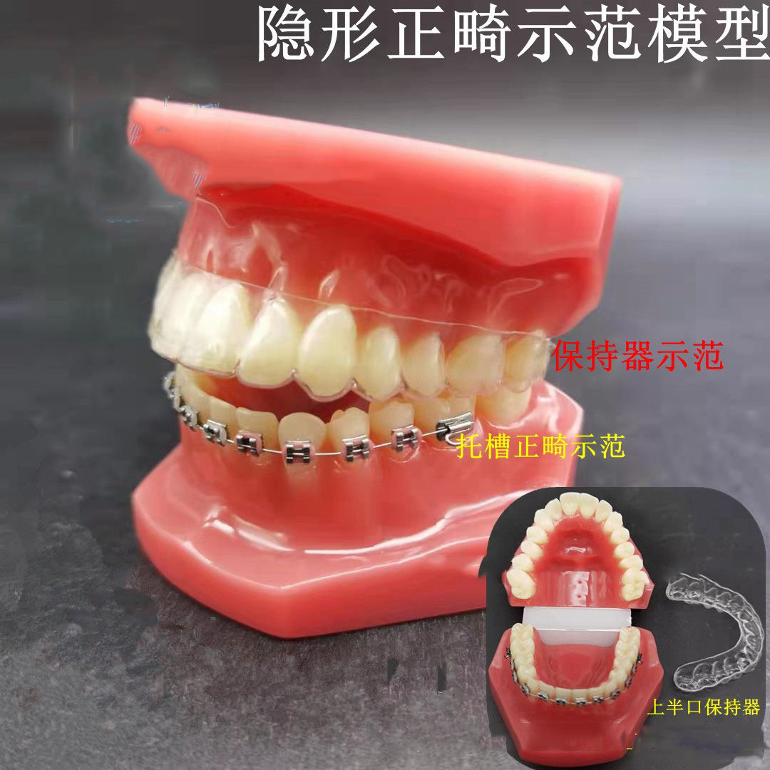 牙科模型口腔透明正畸隐形矫正托槽保持教学金属展示医患沟通
