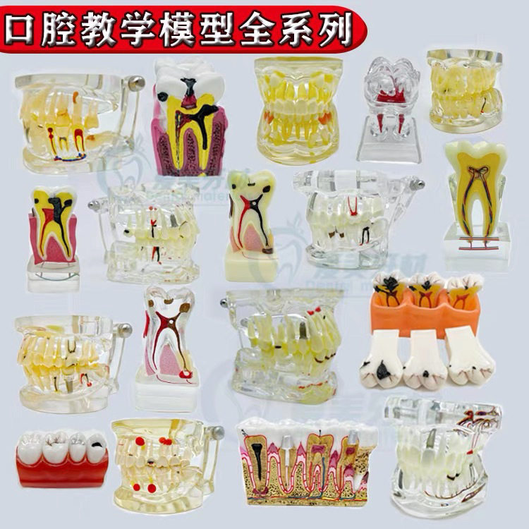 牙科口腔教学牙模 种植修复病理模型 标准28颗备牙模型 蛀牙龋齿
