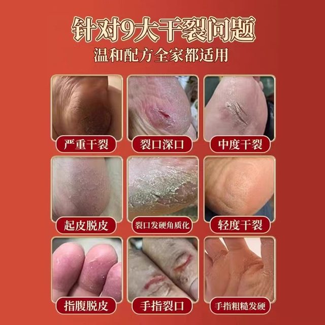 Qingdao Ma Brand Oil Stick Moisturizing Mask Oil Stick Anti-Cracking Old-Fashioned Oil Stick Lip Oil Hand Cream Anti-Cracking for Hands and Feet