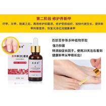 Meikangjing Onychomycosis Antibacterial Liquid Onychomycosis Antibacterial Liquid