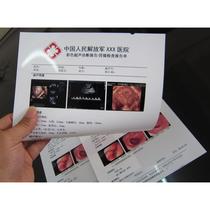Hospital film porcelain white inkjet film A4 film gastroscopy B-ultrasound four-dimensional color ultrasound printing paper 100 sheets
