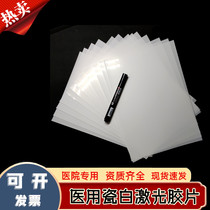 High gloss porcelain white color ultrasound inkjet laser color printing film B ultrasound color ultrasound porcelain white film