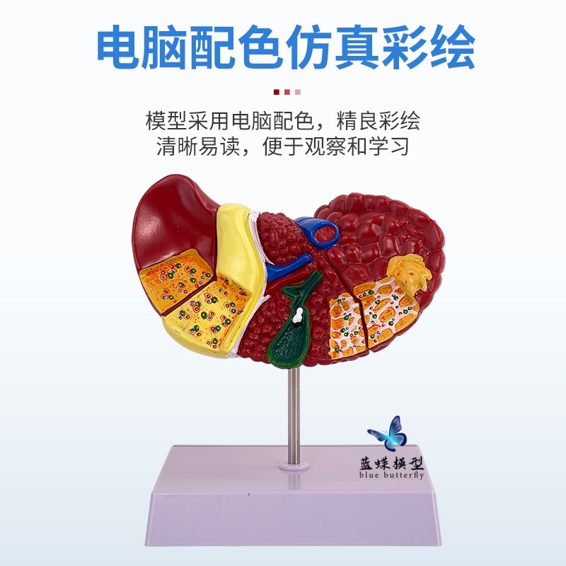 Teaching Simulation Model of Liver, Gallbladder, Pancreas, and Duodenum Structure, Digestive System Medical Liver, Pancreas, and Gallbladder Model