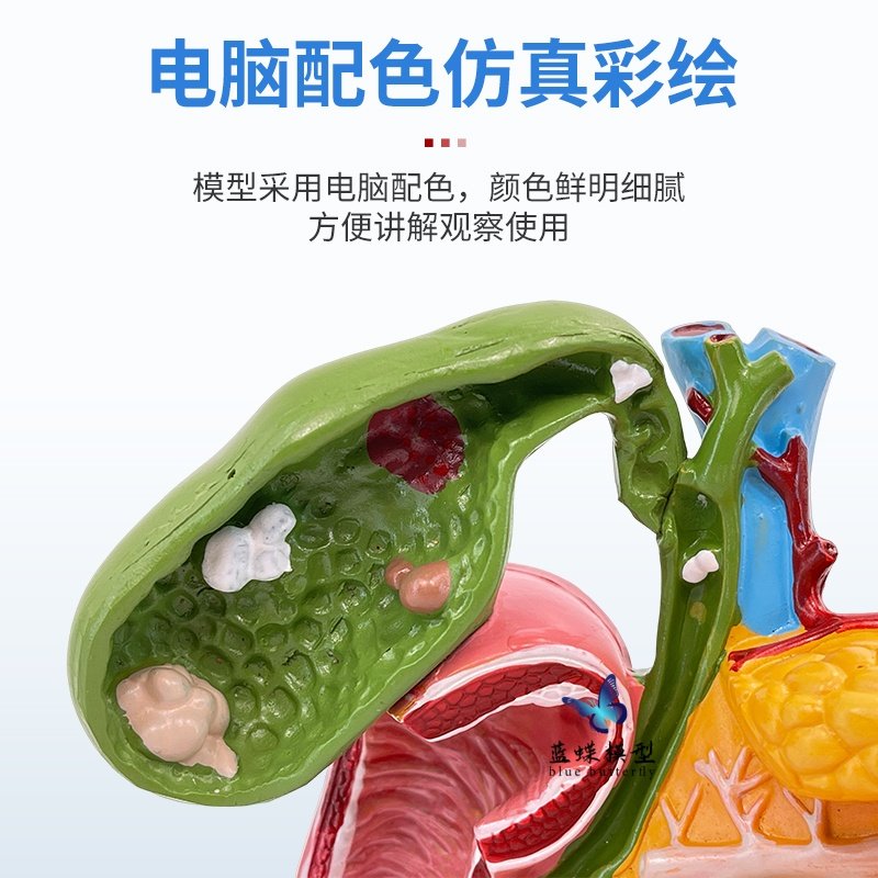 Teaching Simulation Model of Human Pancreas, Duodenum, Gallbladder Pathology, Gallstone Surgery, Digestive System Teaching Aids
