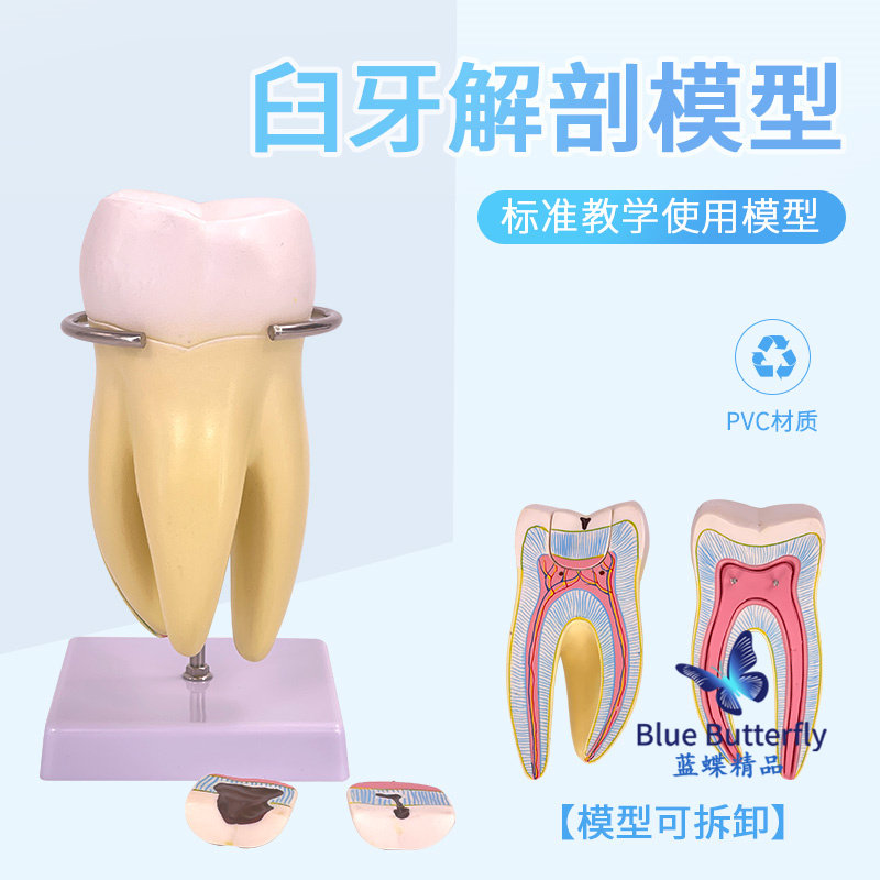 病理大型臼齿模型磨牙可拆卸牙髓蛀牙龋齿儿童牙列切牙口腔牙科用