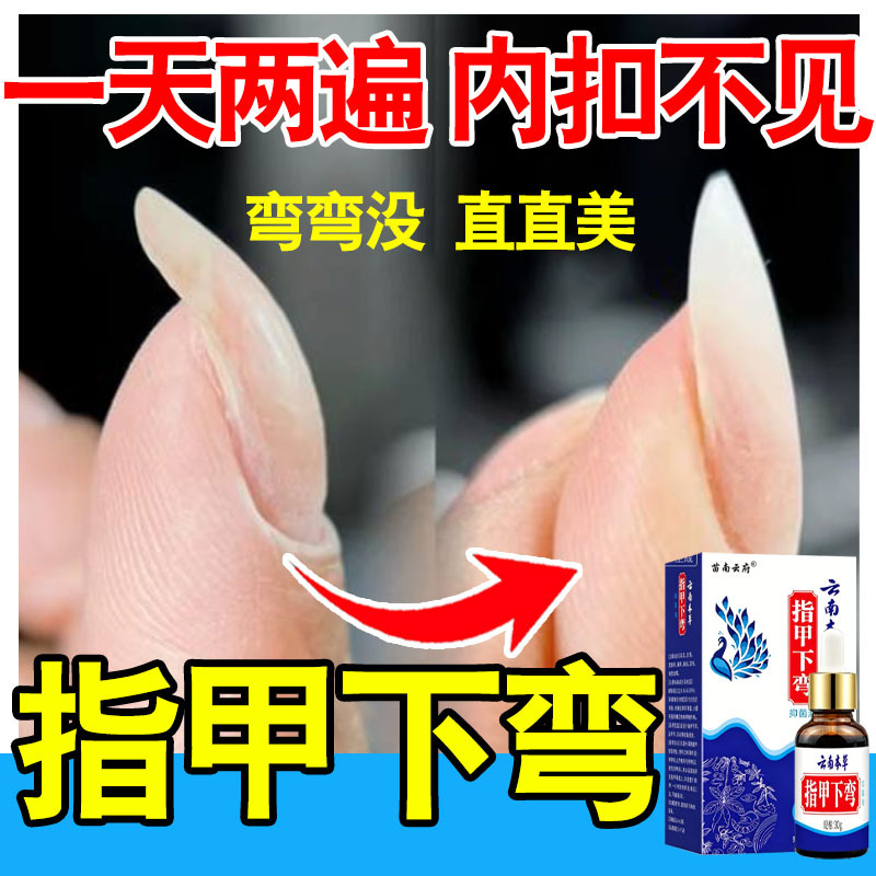 Nails on Hands and Feet Bend Downward, Deform, and Curve Upwards, Resulting in Unevenness; Correction of Nail Bed; Herbal Repair and Nail Care Nails on Hands and Feet Bend Downward, Deform, and Curve Upwards, Resulting in Unevenness; Correction of Nail Bed; Herbal Repair and Nail Care