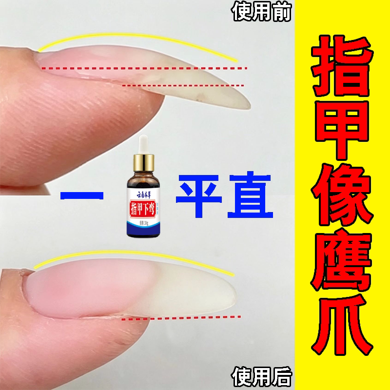 Nails Curved Downward, Nails Curved Upward, Nail Surface Uneven, Nail Flesh Separated and Cracked, Herbal Repair