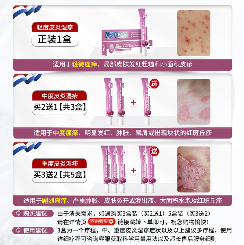 湿疹膏能根治顽固皮炎？神经性汗疱疹止痒去根全解析