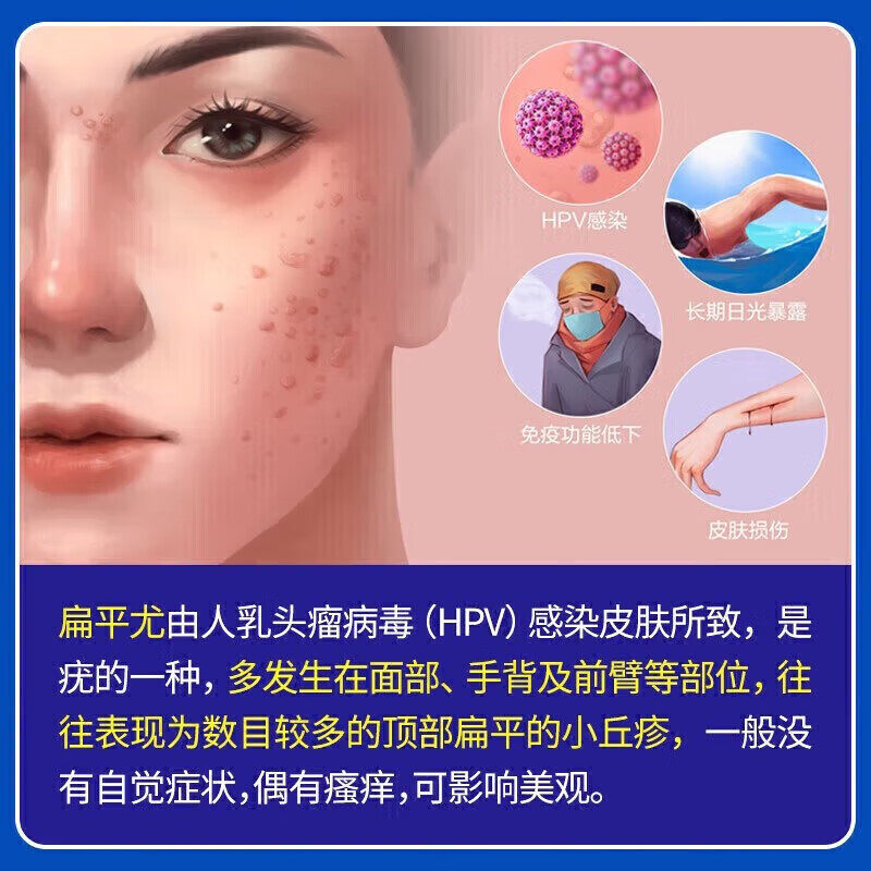 猴子去除药膏水杨酸W1,解决刺猴烦恼_游戏皮肤_淘宝游戏网
