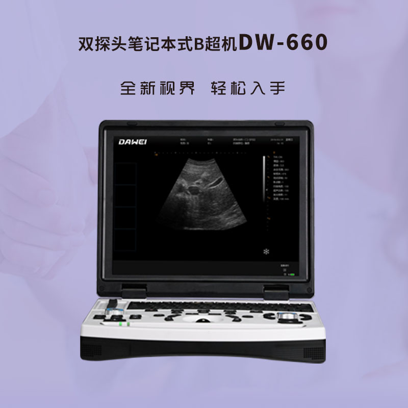 便携式b超笔记本式双接口黑白B超全数字笔记本式超声诊断仪