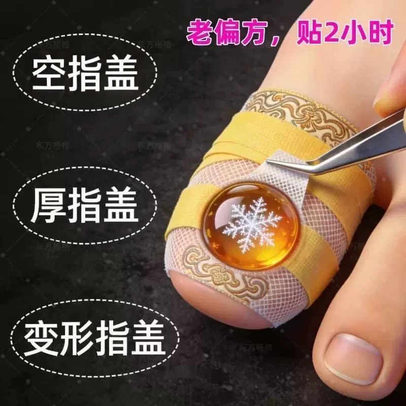 【Strong Nail Cleaner】Plant Extract Special Nail Cleaner and Peeler, Universal Nail Stickers, Genuine Toe Stickers 【Strong Nail Cleaner】Plant Extract Special Nail Cleaner and Peeler, Universal Nail Stickers, Genuine Toe Stickers